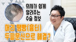 의느님답변📂ㅣ흉터에 두피 문신 얼마나 자연스러울까?