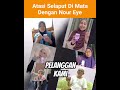 Atasi Selaput Mata Dengan Nour Eye