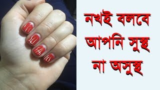 নখ বলবে আপনার শরীর সুস্থ নাকি অসুস্থ/Nails say your body is healthy or ill