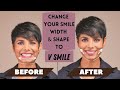 How to CHANGE Your SMILE Width and Shape to V SMILE