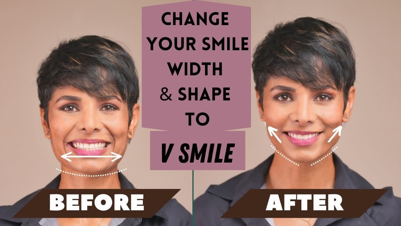 How To CHANGE Your SMILE Width And Shape To V SMILE - YouTube