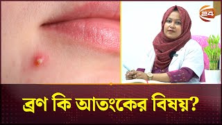 ব্রণ কি আতংকের বিষয়? | Dr. Papia Heven | Acne Removing | Channel 24