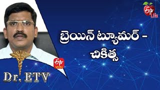 Brain Tumor - Treatment | బ్రెయిన్ ట్యూమర్ - చికిత్స | Dr.ETV | 30th July 2022 | ETV Life