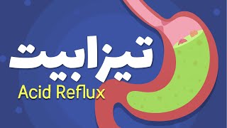 GERD Acid Reflux ||  پیٹ کی جلن کی وجہ؟ تیزابیت کا علاج