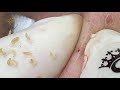 satisfying relaxing with sac dep spa video 122