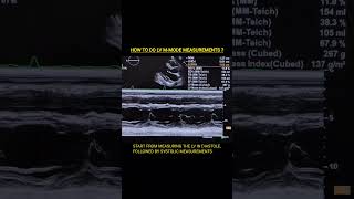 LV M-mode Measurements #echocardiography #echo #cardiology #ultrasound #cardiachealth #hearthealth