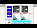 Medical Image Compression Using Matlab Source Code | Image Compression IEEE Project Code