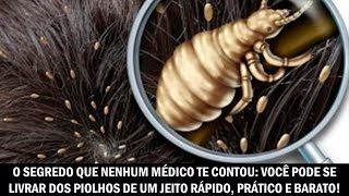 O Segredo Que Nenhum Médico Te Contou: Você Pode Se Livrar Dos Piolhos De Um Jeito Rápido E Prático