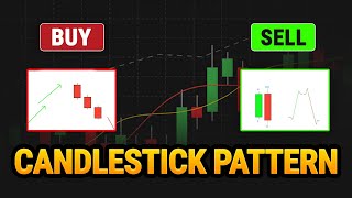 Ultimate Candlestick Pattern Guide | Master Forex Trading