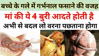 बच्चे के गले में गर्भनाल फसने की वजह मां की ये 4 बुरी आदते|Umbilical cord wrapped around baby neck|