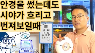 안경을 써도 흐려보이는 시력 개선방법!