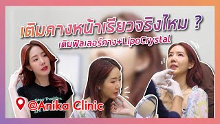 เติมฟิลเลอร์คางครั้งแรก หน้าเปลี่ยนเลยจริงไหม ? | รีวิวฉีดฟิลเลอร์คาง Anika Clinic