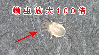 把蟎蟲放大100倍！顯微鏡下的蟎蟲長得這麼可愛！ 【歪點子實驗室】