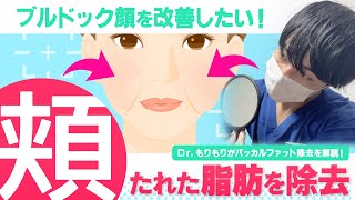 【小顔】適応を知らなきゃ後悔する！？バッカルファット除去術で失敗する人は〇〇です【美容整形】