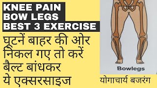 3 best exercises । knee pain ok। घूटनों के टेडापंन को ठीक करें।  BOW LEG EXERCISE ।