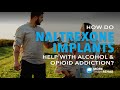 How Naltrexone Implants Work for Alcohol & Opioid Addiction | More Than Rehab