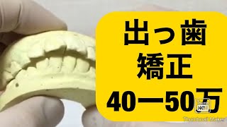 257)出っ歯口ゴボ　費用安い矯正 白いワイヤー矯正もします 埼玉大宮 鈴木歯科医院