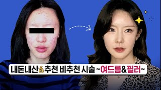 내돈내산 필러 (이마 / 애교살 / 코 / 볼 / 입술) 후기 | 필러 부작용 | 여드름 피부 탈출기