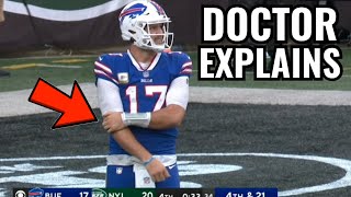 Doctor Explains Josh Allen Elbow Injury - What Happened?