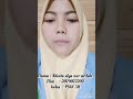 Roleplay Teknik Relaksasi Nafas Dalam dan Distraksi Pada Ibu Hamil