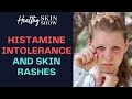 HISTAMINE Intolerance + Skin Rashes (PART 1) | Jennifer Fugo