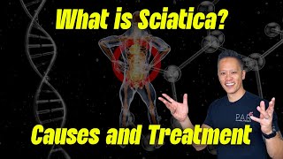 Understanding Sciatica: Causes and Treatment Options