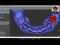 How to use Mesh Editor in coDiagnostiX