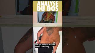 Analyse du Dos