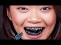 teeth whitening tips not sponsored sinhala beauty tips 2021