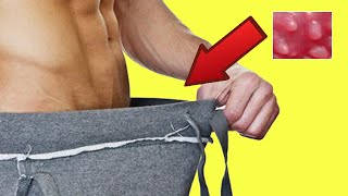 Como curar las papulas perladas con pasta dental