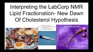 Interpreting LabCorp NMR LipoProfile - New Dawn of The Cholesterol Hypothesis