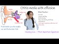 Otitis media with Effusion  - Most common cause of hearing loss in kids