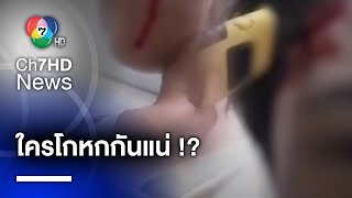 ตรวจเส้นผม-สุขภาพจิต \