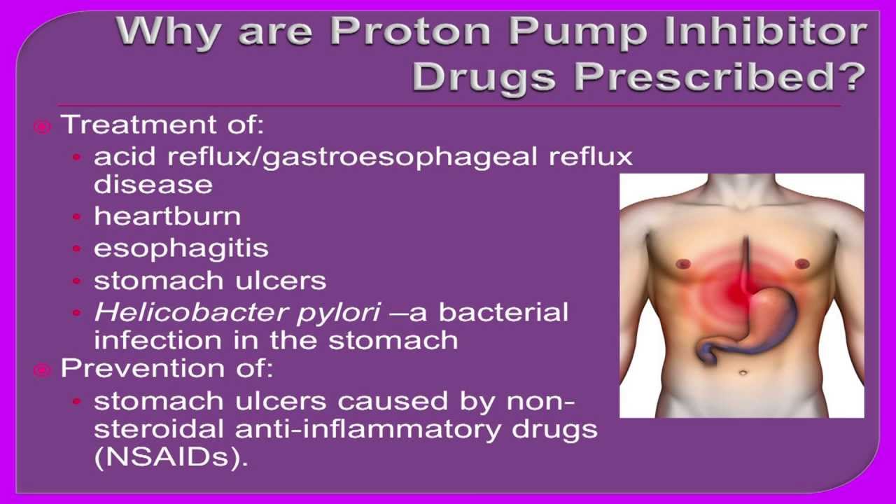 Proton Pump Inhibitors Examples At Patricia Henderson Blog