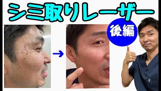 【シミ取り】シミ取りレーザーやってみた（後編）〜シミ取りレーザーは痛くないのか？シミは取れたのか？〜【千葉市の腰痛専門整体院「快」】