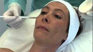 DermaCeutic Soft Peel Demo | Nu-U Essentials MediSpa