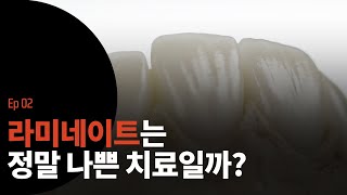 라미네이트, 정말 나쁜 치료일까? [오닥터 리포트 Ep 02]