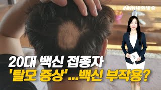 내외방송 뉴스 / 20대 백신 접종자들, '탈모 증상'...백신 부작용?