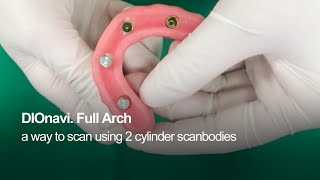 DIOnavi. Full Arch tips when using a Cylinder Scanbody