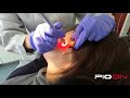 Pioon Diode Dental Laser TMJ Treatment