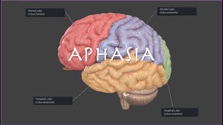 Broca's or Wernicke's Aphasia on the NPTE?