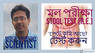 মল পরীক্ষা, Stool Test, Stool Analysis,পায়খানা পরীক্ষা Mol Pariksha