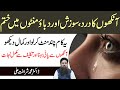 Aankh Dard Ka ilaj | Aankh Ki Sozish Ka | Aankh Ki Swelling | Aankh Ki Sujan Ka ilaj Dr Sharafat Ali