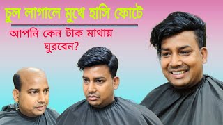 চুল লাগিয়ে মুখে হাসি ফোটাবে | টেপ \u0026 গ্লু সিস্টেম হেয়ার রিপ্লেসমেন্ট | আলগা চুলের দাম?