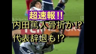 内田篤人  骨折か⁉︎代表辞退も⁉︎