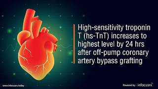 High-sensitivity troponin T levels peak at 2 hours post-coronary artery bypass grafting.