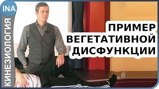 Пример дисфункции вегетативной нервной системы. Прикладная кинезиология