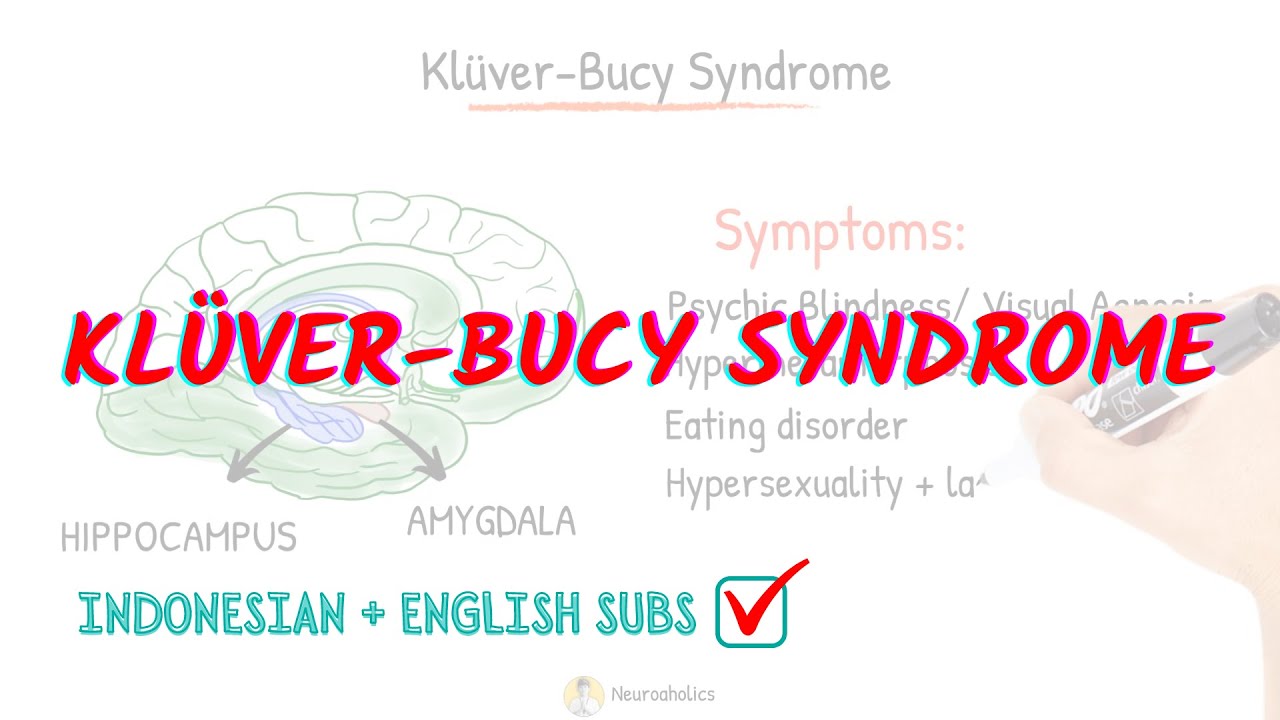 Kluver Bucy Syndrome Detail Explanation | Neuroaholics - YouTube