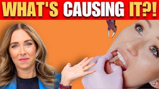 Weak Bones Tooth Decay Here S What S Actually Causing It Dr Janine
