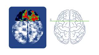 Memories Matter: ADDF's Scientific Approach